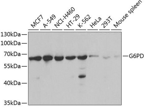 Anti-G6PD antibody produced in rabbit