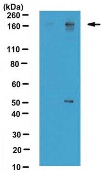 Anti-dimethyl-BAF155 Antibody (Arg1064, asymetrically di-methylated) from rabbit, purified by affinity chromatography