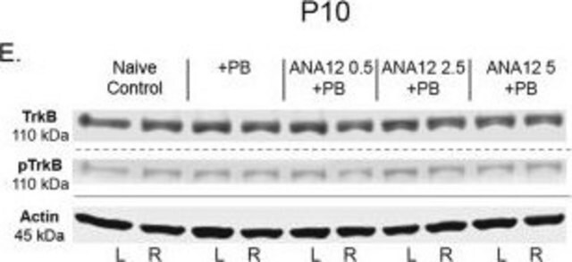 Anti-phospho-TrkB (Tyr816) Antibody from rabbit, purified by affinity chromatography