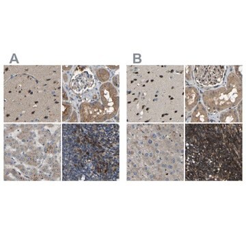 Anti-ATP8B1 antibody produced in rabbit Prestige Antibodies&#174; Powered by Atlas Antibodies, affinity isolated antibody, buffered aqueous glycerol solution, Ab2