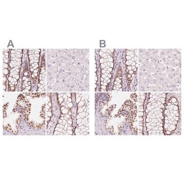 Anti-HOXB13 antibody produced in rabbit Prestige Antibodies&#174; Powered by Atlas Antibodies, affinity isolated antibody, buffered aqueous glycerol solution