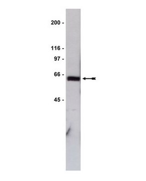 Anti-GST Tag Antibody Upstate&#174;, from rabbit