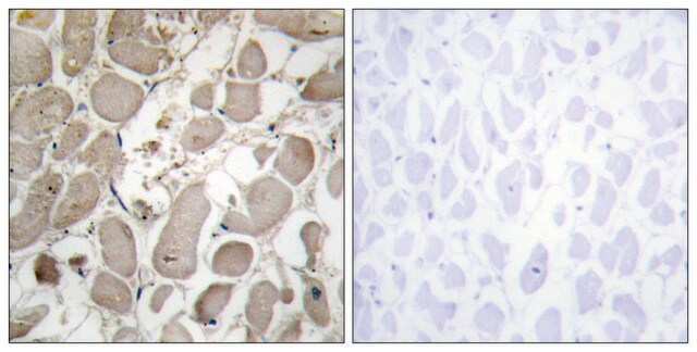 Anti-Collagen V &#945;1 antibody produced in rabbit affinity isolated antibody