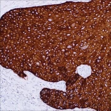 Cytokeratin 14 (SP53) Rabbit Monoclonal Antibody