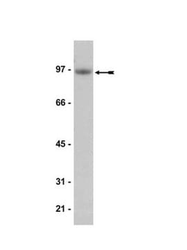 Anti-IGF-IR Antibody, clone JBW902 clone JBW902, Upstate&#174;, from mouse