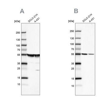 Anti-TUBA1A antibody produced in rabbit Prestige Antibodies&#174; Powered by Atlas Antibodies, affinity isolated antibody, buffered aqueous glycerol solution