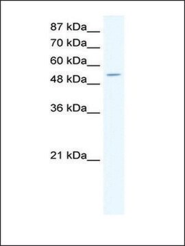 Anti-CPA1 antibody produced in rabbit affinity isolated antibody