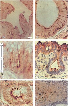 Monoclonal Anti-Phosphotyrosine antibody produced in mouse clone PT-66, ascites fluid