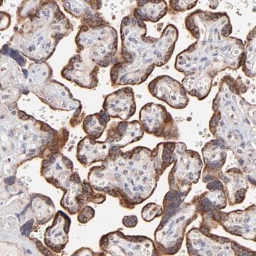 Anti-MAP2K7 antibody produced in rabbit Prestige Antibodies&#174; Powered by Atlas Antibodies, affinity isolated antibody, buffered aqueous glycerol solution