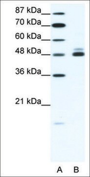 Anti-CHRNB2 antibody produced in rabbit affinity isolated antibody