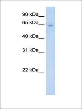 Anti-CYP2E1 affinity isolated antibody