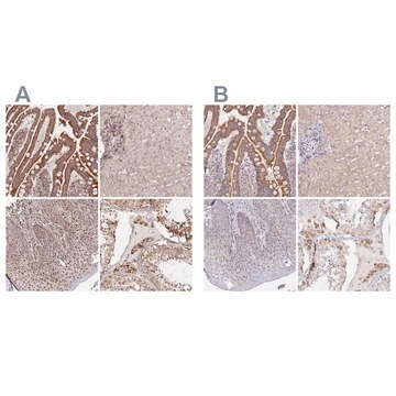 Anti-MAVS antibody produced in rabbit Prestige Antibodies&#174; Powered by Atlas Antibodies, affinity isolated antibody, buffered aqueous glycerol solution