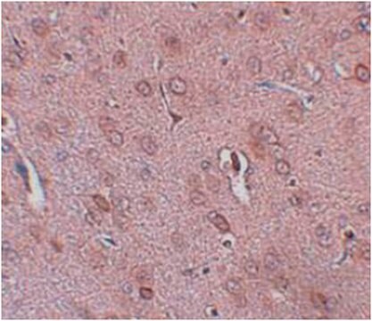 Anti-TRESK Antibody from rabbit, purified by affinity chromatography