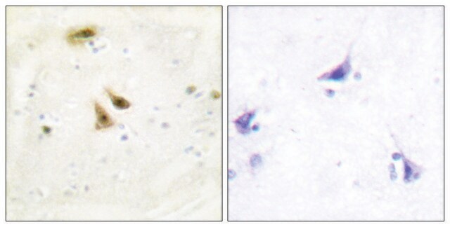 Anti-UBF1 antibody produced in rabbit affinity isolated antibody