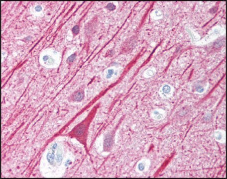 Anti-VISA (AB1) antibody produced in rabbit affinity isolated antibody, buffered aqueous solution