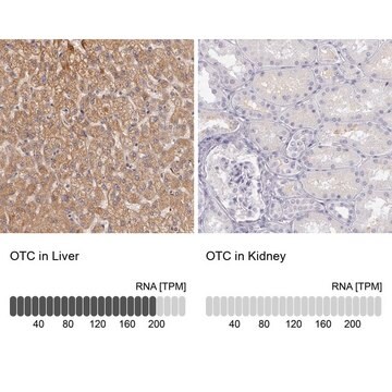 Anti-OTC antibody produced in rabbit Ab2, Prestige Antibodies&#174; Powered by Atlas Antibodies, affinity isolated antibody, buffered aqueous glycerol solution