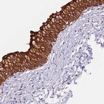 Anti-DENND2D antibody produced in rabbit Prestige Antibodies&#174; Powered by Atlas Antibodies, affinity isolated antibody, buffered aqueous glycerol solution