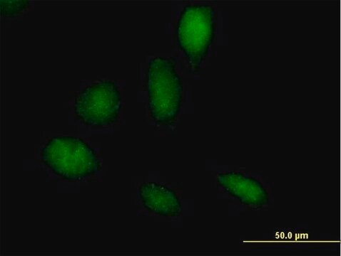 Anti-RECQL5 antibody produced in mouse purified immunoglobulin, buffered aqueous solution