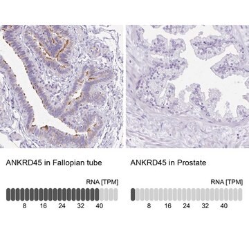 Anti-ANKRD45 antibody produced in rabbit Prestige Antibodies&#174; Powered by Atlas Antibodies, affinity isolated antibody, buffered aqueous glycerol solution, ab3