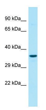 Anti-G6PC3 (N-terminal) antibody produced in rabbit affinity isolated antibody