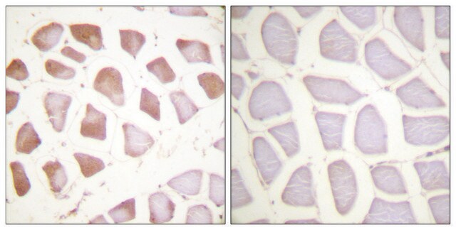 Anti-TNNI3 antibody produced in rabbit affinity isolated antibody