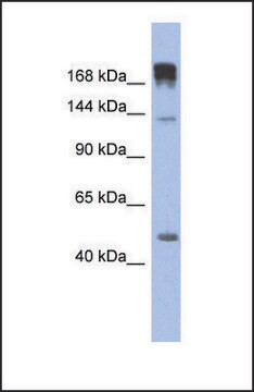 Anti-SLIT3, (N-terminal) antibody produced in rabbit affinity isolated antibody