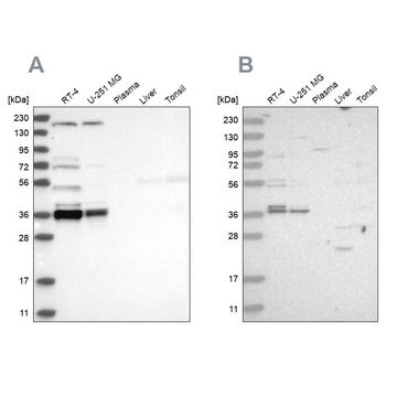 Anti-C1orf131 antibody produced in rabbit Prestige Antibodies&#174; Powered by Atlas Antibodies, affinity isolated antibody, buffered aqueous glycerol solution, ab2