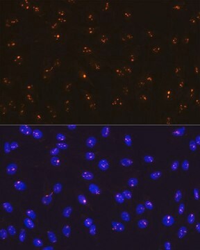 Anti-Fibrillarin/U3 RNP antibody produced in rabbit