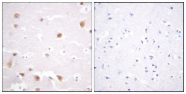 Anti-CKII-&#946; antibody produced in rabbit affinity isolated antibody