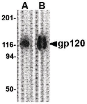 Anti-GP120 antibody produced in rabbit affinity isolated antibody