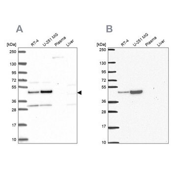 Anti-RRS1 antibody produced in rabbit Prestige Antibodies&#174; Powered by Atlas Antibodies, affinity isolated antibody, buffered aqueous glycerol solution