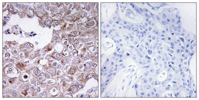 Anti-MUC1 antibody produced in rabbit affinity isolated antibody