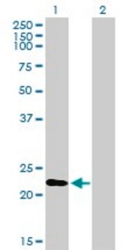 Anti-RGS1 antibody produced in mouse purified immunoglobulin, buffered aqueous solution