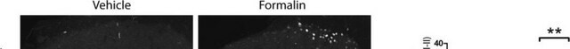 Anti-Calcitonin Gene Related Peptide antibody produced in rabbit whole antiserum