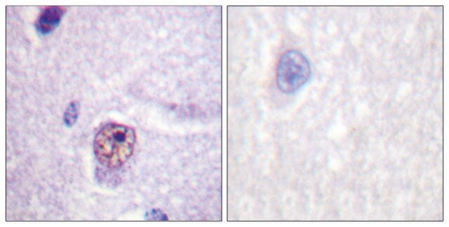 Anti-SF1, N-Terminal antibody produced in rabbit affinity isolated antibody