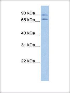 Anti-JPH2 antibody produced in rabbit affinity isolated antibody