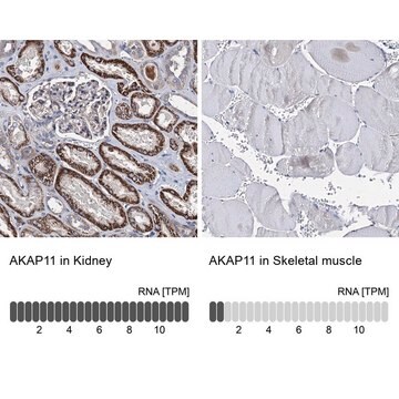 Anti-AKAP11 antibody produced in rabbit Prestige Antibodies&#174; Powered by Atlas Antibodies, affinity isolated antibody, buffered aqueous glycerol solution