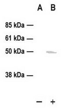 PhosphoDetect Anti-p53 (pSer&#185;&#8309;) (Ab-3) Rabbit pAb liquid, Calbiochem&#174;