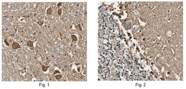 Anti-S100B Antibody from rabbit, purified by affinity chromatography