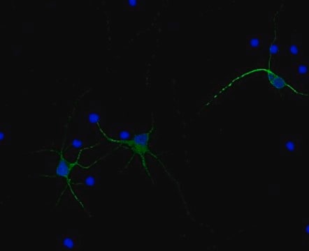 Anti-MAP2, Alexa Fluor&#8482; 488 Conjugate Antibody from rabbit, ALEXA FLUOR&#8482; 488