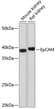 Anti-EpCAM Antibody, clone 2Y2E0, Rabbit Monoclonal