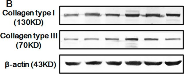 Monoclonal Anti-Collagen, Type III antibody produced in mouse clone FH-7A, ascites fluid