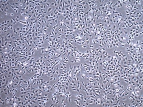 TC28a2 Human Chondrocyte Cell Line TC28a2 Human Chondrocyte Cell Line is widely used as a model cell line for studying normal and pathological cartilage repair mechanisms related to chondrocyte biology and physiology.