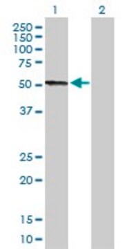 Anti-CPB2 antibody produced in rabbit purified immunoglobulin, buffered aqueous solution