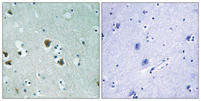 Anti-CRMP-2 antibody produced in rabbit affinity isolated antibody