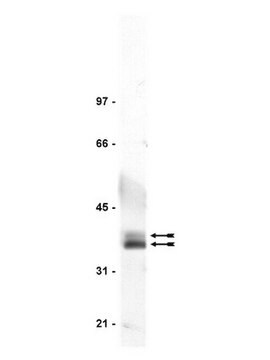 Anti-LAT Antibody Upstate&#174;, from rabbit