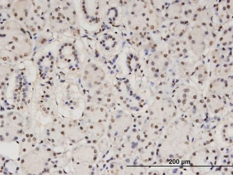 Monoclonal Anti-CBFA2T2 antibody produced in mouse clone 2C10, purified immunoglobulin, buffered aqueous solution