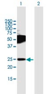 Anti-TMEM123 antibody produced in mouse purified immunoglobulin, buffered aqueous solution