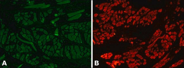 Anti-Myosin (Skeletal) antibody produced in rabbit whole antiserum