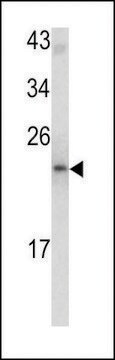 ANTI-MCT-1(N-TERMINAL) antibody produced in rabbit purified immunoglobulin, buffered aqueous solution